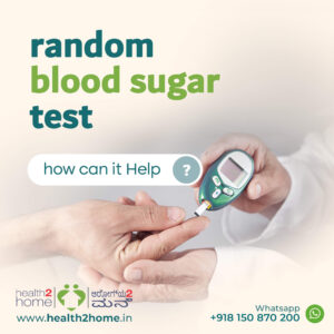 Random blood sugar testing