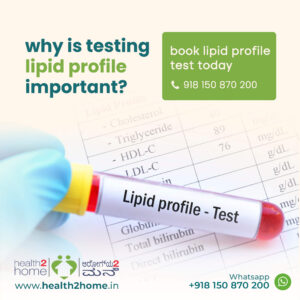 lipid profile test