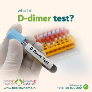 what is D-dimer test diagnostic blood test